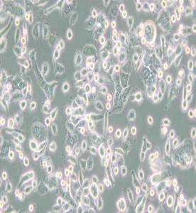 AsPC-1人轉(zhuǎn)移胰腺腺癌細胞主圖
