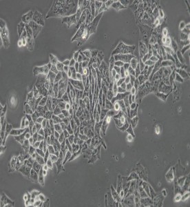 BEL-7402人肝癌細(xì)胞主圖