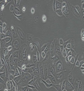 GBC-SD人膽囊癌細胞主圖