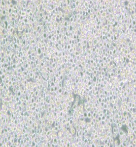 PC 61 5.3 [PC 61; PC 61.5.3]雜交瘤細(xì)胞CD25主圖