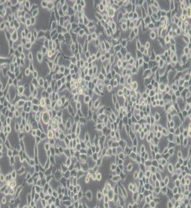 KB人口腔表皮樣癌細胞主圖