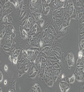 MCF7[MCF-7]人乳腺癌細(xì)胞主圖