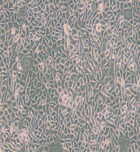 B82小鼠腫瘤細(xì)胞系主圖