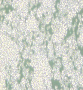 EL-4-B5小鼠胸腺淋巴瘤細(xì)胞主圖