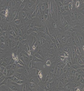 Vero非洲綠猴腎細(xì)胞主圖