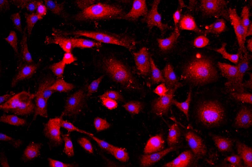 小鼠肺微血管內(nèi)皮細(xì)胞主圖