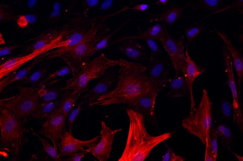 大鼠氣管平滑肌細胞主圖
