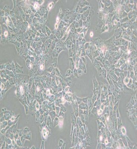 SK-N-AS人神經(jīng)母細胞瘤細胞主圖