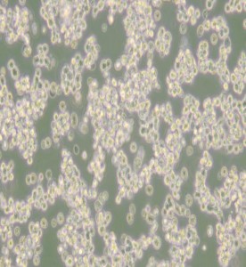 SK-NEP-1人腎母細(xì)胞瘤細(xì)胞主圖