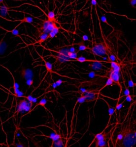 大鼠皮層神經(jīng)元細胞主圖