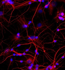 大鼠海馬神經(jīng)元細(xì)胞主圖