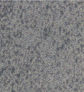 NAMALWA人Burkitt's淋巴瘤細(xì)胞主圖