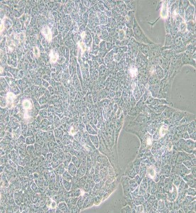 NCI-H2228[H2228; H-2228]人肺癌細(xì)胞主圖