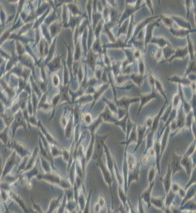 RKO-AS45-1人結(jié)腸癌轉(zhuǎn)基因細(xì)胞主圖