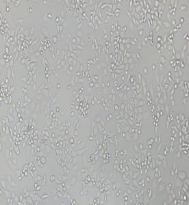 RKO-E6人結(jié)腸癌轉(zhuǎn)基因細(xì)胞主圖