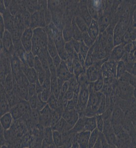 SCaBER人膀胱鱗癌細(xì)胞主圖