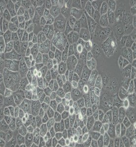 SW-13人腎上腺皮質(zhì)小細(xì)胞癌細(xì)胞(DMEM)主圖