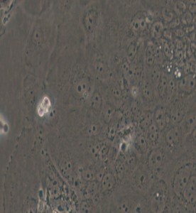 SW1463人大腸癌細(xì)胞主圖