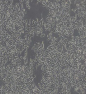 TT人甲狀腺導管癌細胞主圖