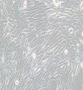 U-118 MG人腦星形膠質(zhì)母細(xì)胞瘤主圖