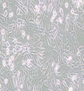 UM-UC-3人膀胱移行細(xì)胞癌主圖