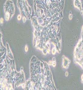 VCaP人前列腺癌細(xì)胞主圖