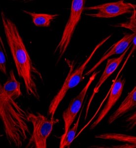人支氣管成纖維細(xì)胞主圖