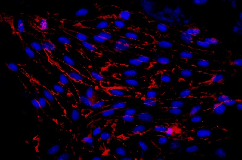 小鼠肺大動(dòng)脈內(nèi)皮細(xì)胞主圖