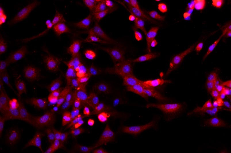 小鼠骨骼肌細(xì)胞主圖