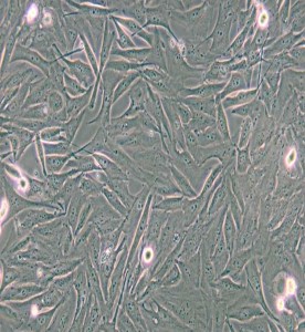 A2058人皮膚癌細(xì)胞主圖