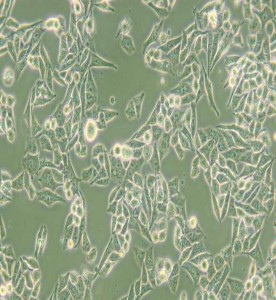 AN3 CA人子宮內(nèi)膜腺癌細胞主圖