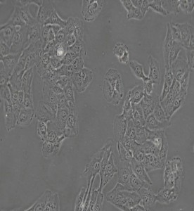 HT-1080[HT1080]人纖維肉瘤細(xì)胞主圖