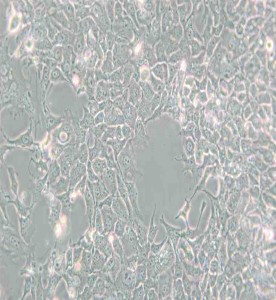 HCC827人非小細(xì)胞肺癌細(xì)胞主圖